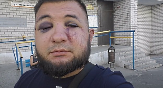Гаспар Авакян после нападения. Скриншот видео канала Гаспара Авакяна, https://www.youtube.com/watch?v=nETUnhpN56I Гаспар Авакян после нападения. Скриншот видео канала Гаспара Авакяна, https://www.youtube.com/watch?v=nETUnhpN56I