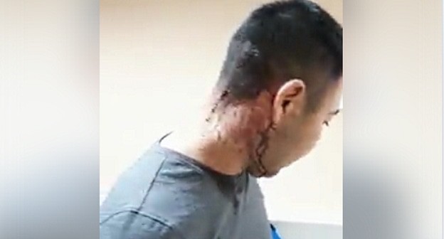 Арслан Кусьминов после нападения. скриншот видео https://www.facebook.com/people/Арслан-Кусьминов/100006289414442 Арслан Кусьминов после нападения. скриншот видео https://www.facebook.com/people/Арслан-Кусьминов/100006289414442
