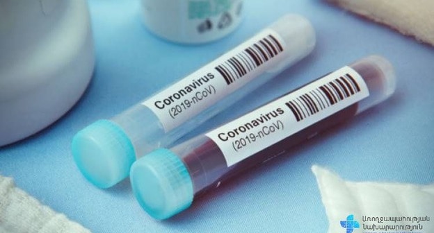 Анализ крови на COVID-19. Фото пресс-службы Минздрава Армении. https://www.facebook.com/ministryofhealthcare/ Анализ крови на COVID-19. Фото пресс-службы Минздрава Армении. https://www.facebook.com/ministryofhealthcare/