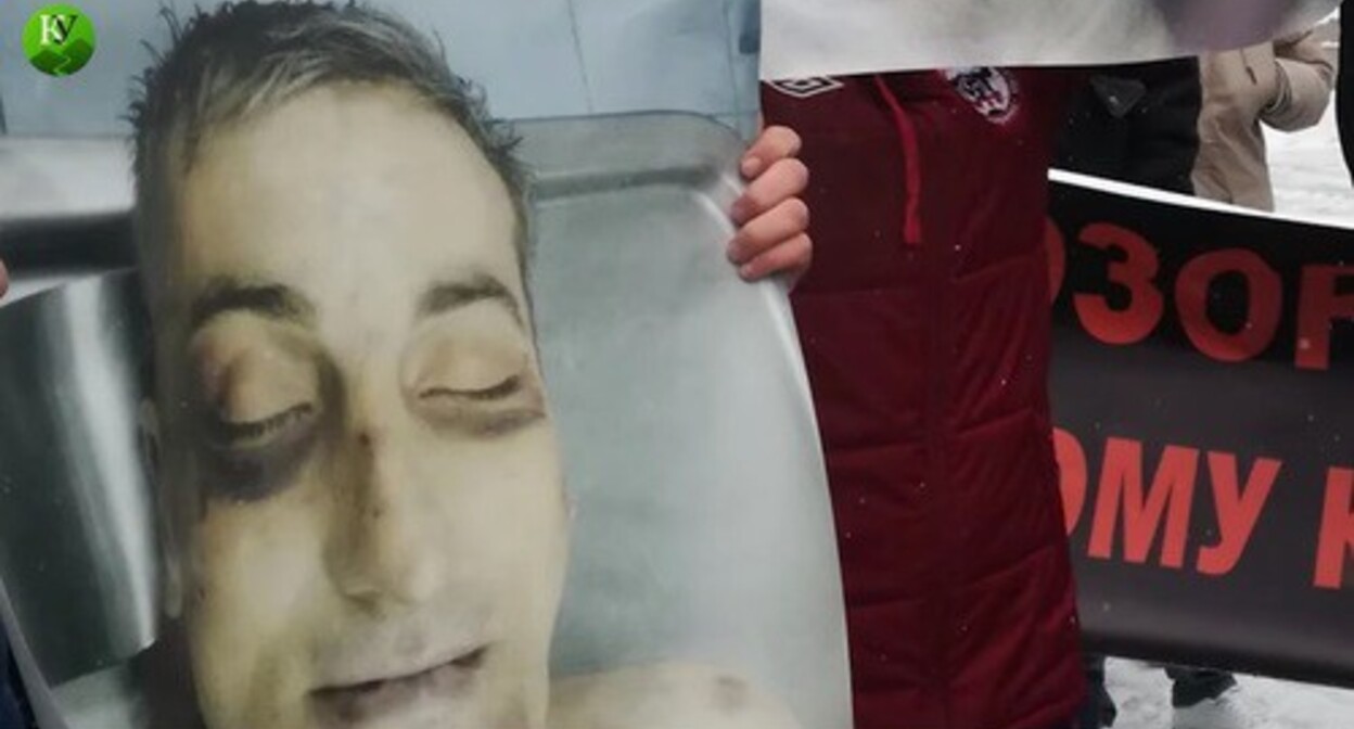 Фрагмент плаката с изображением следов пыток на лице Владимира Цкаева. Скриншот с видео "Кавказского узла" https://www.youtube.com/watch?v=1Fwh_EBWCo0 Фрагмент плаката с изображением следов пыток на лице Владимира Цкаева. Скриншот с видео "Кавказского узла" https://www.youtube.com/watch?v=1Fwh_EBWCo0
