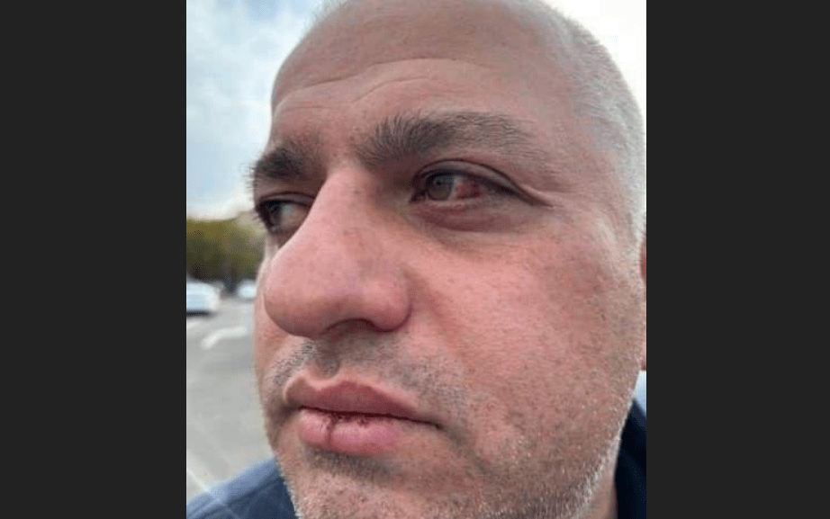 Барамидзе после избиения силовиками. Скриншот фото Tbilisi Life от 19.11.24, https://t.me/Tbilisi_life/31349