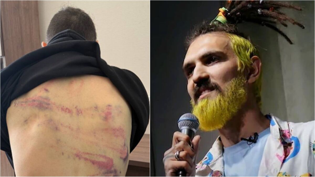 Артемий Останин со следами побоев после задержания и ранее на сцене. Фото: https://t.me/Merkacheva/3467, Telegram-канал "Москва 24"
