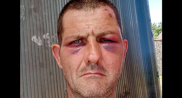 Житель Краснодарского края Федор Валько после избиения. Фото: https://t.me/no_torture/3590